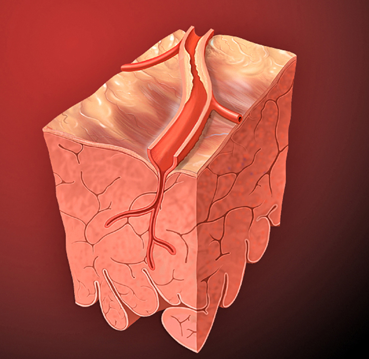 Peripheral artery disease surgery | General center | SteadyHealth.com