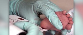 Phenylketonuria is inherited condition