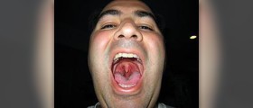 Phlegm in throat
