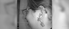 Pierced ear problems
