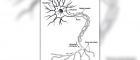 Pinched nerve in back