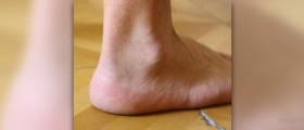 Plantar flexion exercises