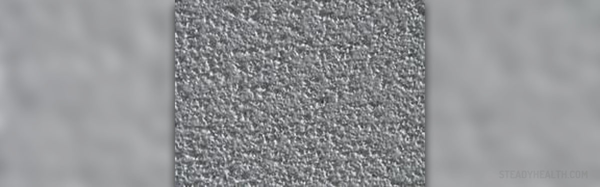 Popcorn Ceiling Asbestos General Center Steadyhealth Com