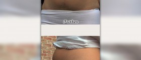 Pregnancy signs before missed period