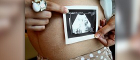 Stages of prenatal development