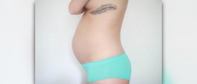 What do you need to do before trying to get pregnant?