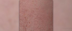 Prepare your skin for effective body hair removal