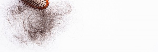 Prescription hair loss teatments: Finasteride