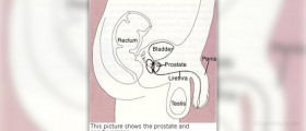 Prevention of benign prostatic hyperplasia