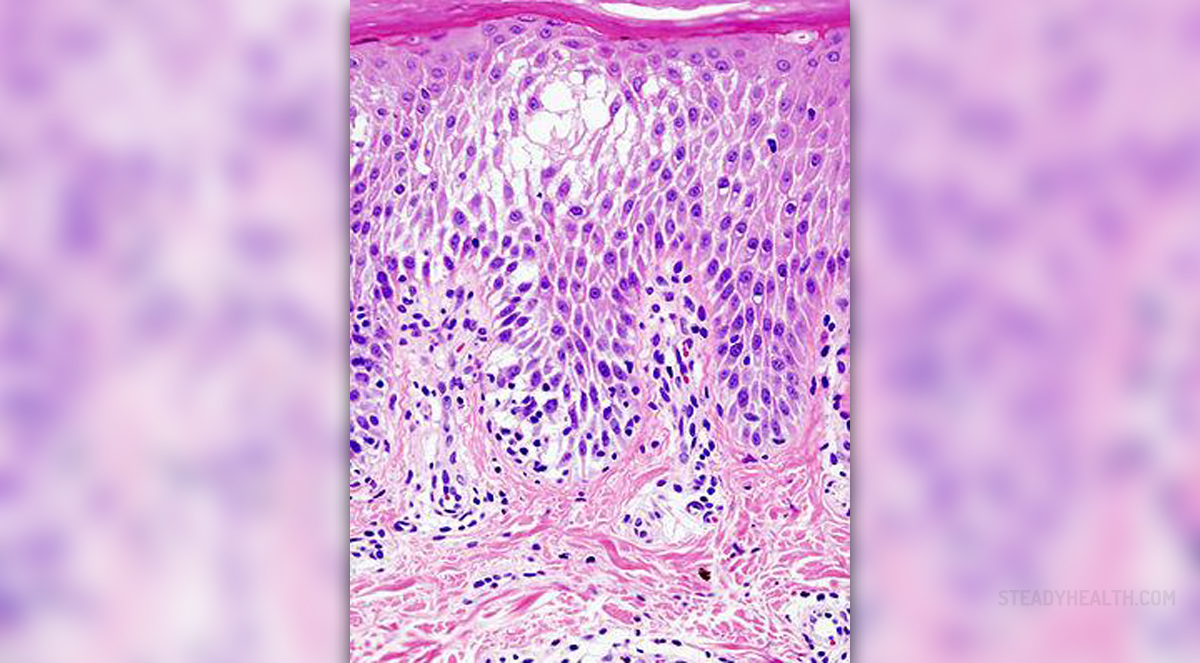 Prevention Of Bovine Spongiform Encephalopathy General Center   Prevention Of Bovine Spongiform Encephalopathy 