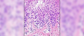 Prevention of bovine spongiform encephalopathy