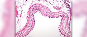 Prevention of bronchitis
