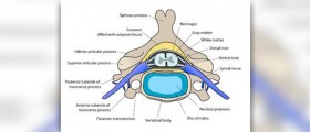 Prevention of cervical spondylosis