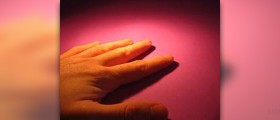 Prevention of dupuytren's contracture