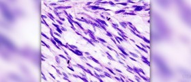 Prevention of fibroids