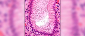 Prevention of gastritis