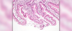 Prevention of giardia