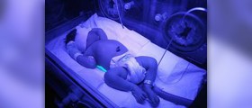 Prevention of jaundice during pregnancy