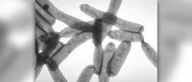 Prevention of legionella