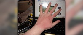 Prevention of liver spots