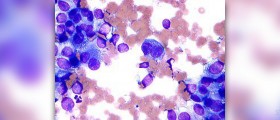 Prevention of melanoma