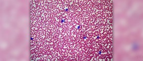 Prevention of norovirus