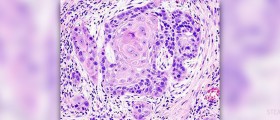 Prevention of oral cancer