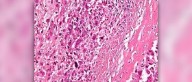 Prevention of osteoporosis
