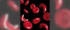 Prevention of sickle cell