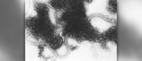 Prevention of west nile virus