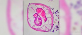 Prevention of worms in humans