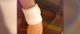 Prevention of wrist injuries