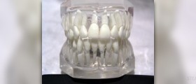 Problems of the teeth and jaw