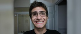 Professional tooth whitening success