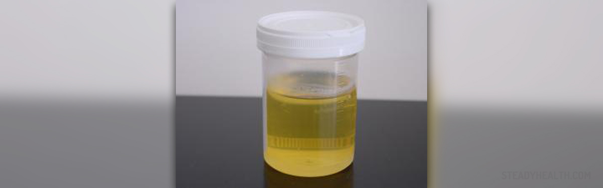 protein-in-urine-in-children-children-s-teens-health-articles