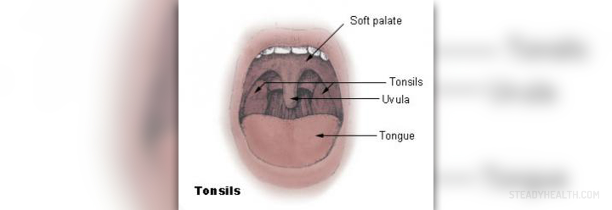 What Causes Pus Pockets On Tonsils