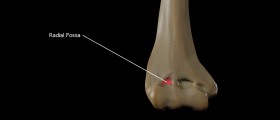 Radial tunnel syndrome surgery