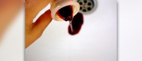 Reasons for choosing bloodless medicine and surgery