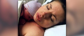 Recovery time for a c-section