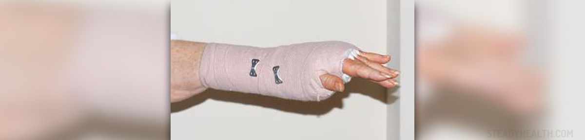 recovery-time-for-carpal-tunnel-surgery-general-center-steadyhealth