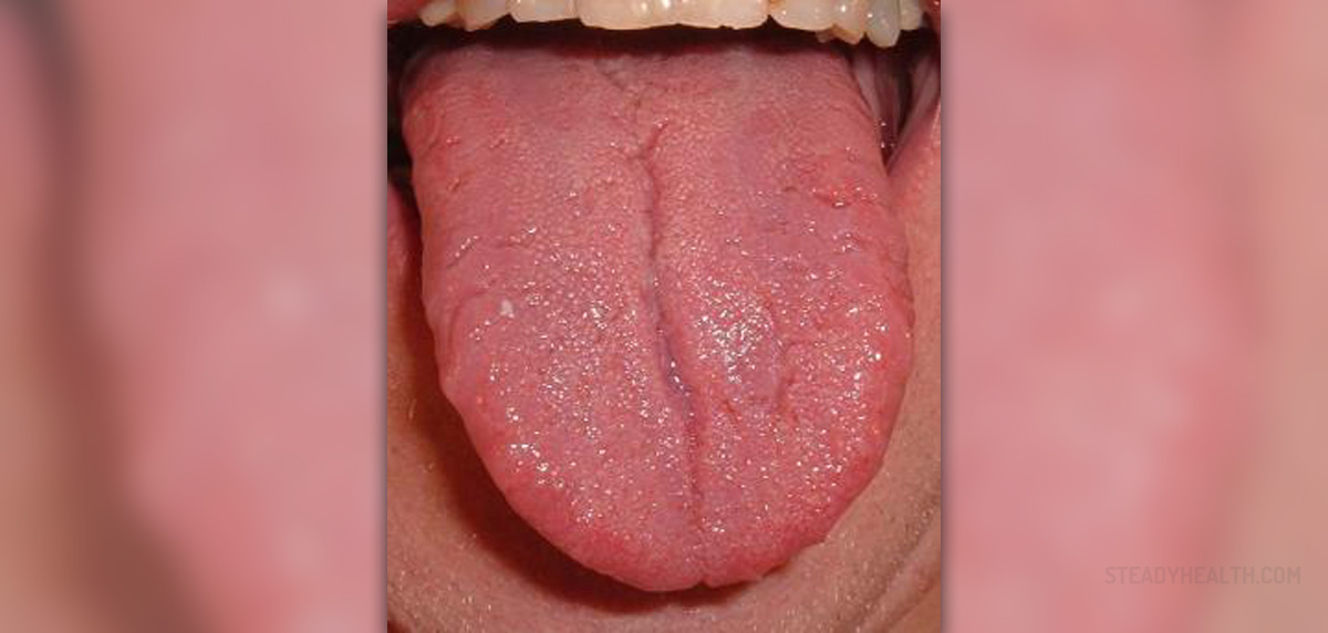 What Do Red Spots On The Tongue Mean