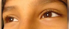Reducing wrinkles around eyes