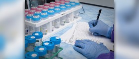 Non-Invasive Technique to Distinguish Healthy Fertile and Infertile Sperm Cells