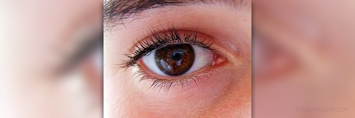 eye torn retina symptoms