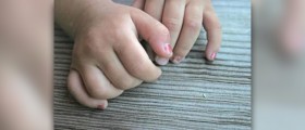 Ridged fingernails facts