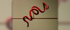 Roundworm symptoms