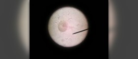 Roundworms characteristics