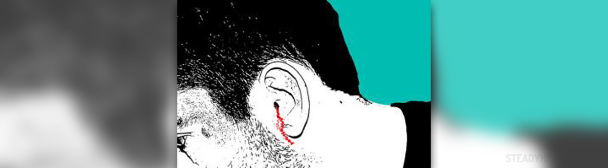 ruptured-eardrum-surgery-general-center-steadyhealth