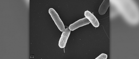 Salmonella poisoning review