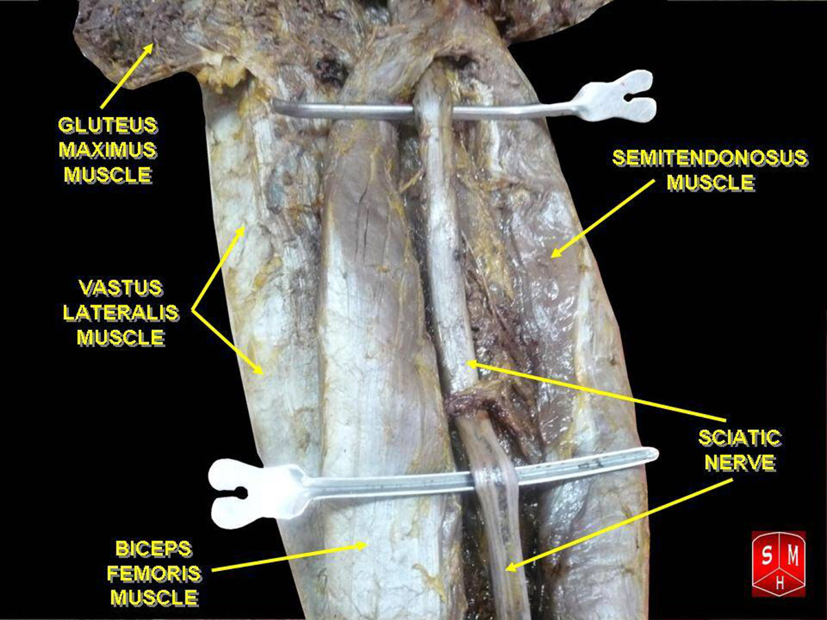 Sciatic nerve treatment | General center | SteadyHealth.com